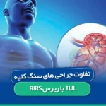 تفاوت جراحی سنگ کلیه ریرس RIRS با TUL