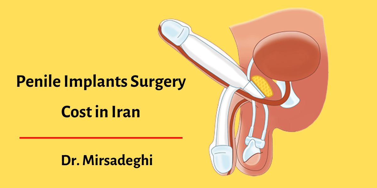 penile implant surgery cost in Iran
