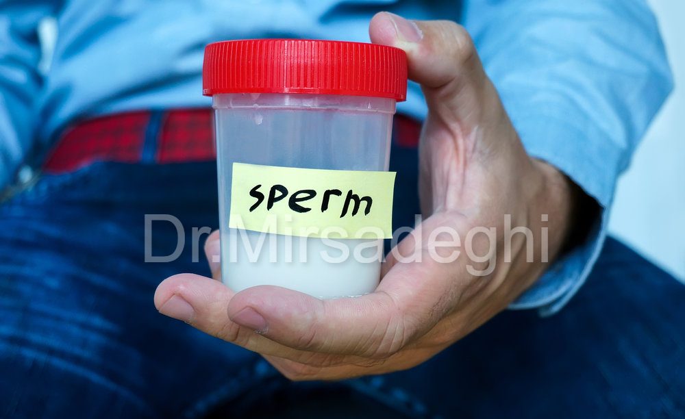 آزمایش اسپرم