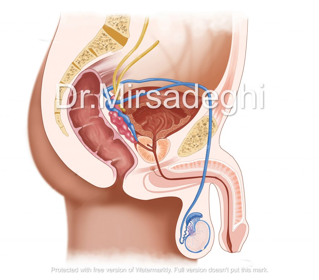 آناتومی مردان و پروستات که پروستات در زیر مثانه قرار دارد.