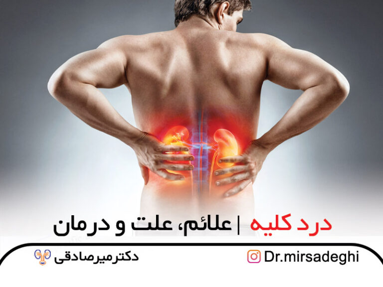 درد کلیه، علائم، علت و درمان سایت رسمی دکتر میرصادقی جراح کلیه